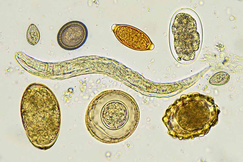 Ascaris lumbricoides (nguyên nhân gây bệnh phổ biến nhất)